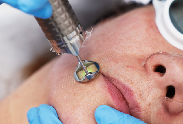 Laseroterapia Wrocław